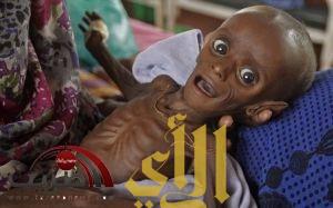 حملة لنجدة الصومال وصورة مفجعه لرضيع صومالي – صور