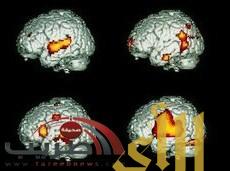 ظواهر دماغية مسؤولة عن الإدمان في الدماغ