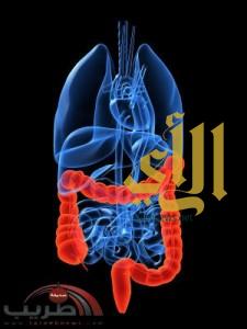 أورام القولون الأكثر انتشارًا وقلقًا في المملكة