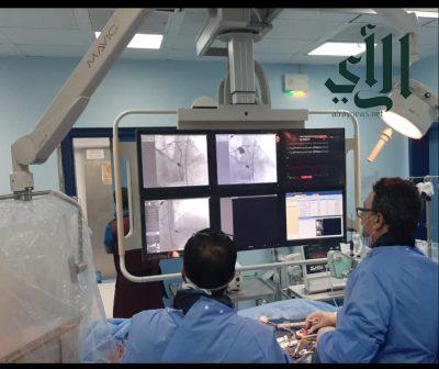 إجراء عمليتي قسطرة بإستخدام مضخة قلبية مؤقتة في مركز #الأمير_سلطان بـ #نجران