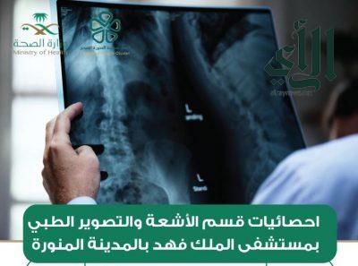 إجراء أكثر من 39 ألف فحص تشخيصي بالأشعة بمستشفى #الملك_فهد بـ #المدينة_المنورة