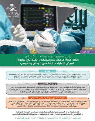 جراحة ناجحة في مستشفى #العيدابي لمصاب بجرح نازف في الفص الأيسر للكبد