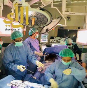 نجاح أول عملية تكميم معدة بمستشفى الامير مشاري ببلجرشي