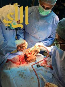 الصحة : إستئصال ورم بالفك العلوي لمريض بمستشفى الملك فهد بجدة