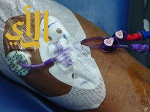 إجراء أول حالة قسطرة وريدية بواسطة جهاز خاص لعلاج الأورام بمستشفى الأمير محمد بن ناصر بجازان