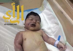 في بيشة : التحقيق في وفاة طفل بمستشفى حكومي